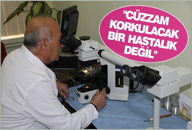 "CÜZZAM KORKULACAK BİR HASTALIK DEĞİL"