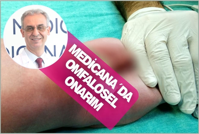 MEDİCANA´DA OMFALOSEL ONARIM