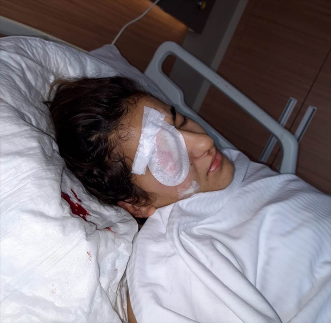 ÇAMCI, AMELİYAT OLDU