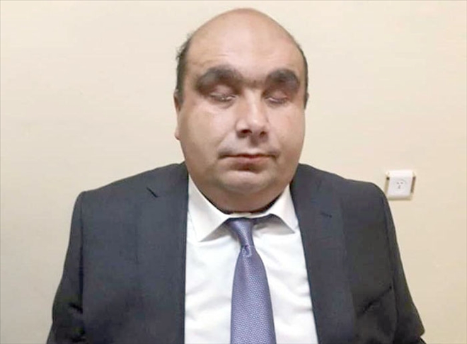 SORUNLARIN ÜZERİNE GİDECEĞİZ