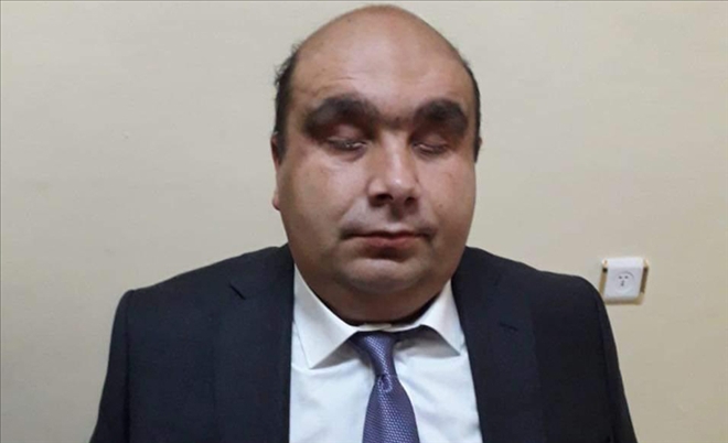 ENGELİ ENGELLE HAYATI DENGELE