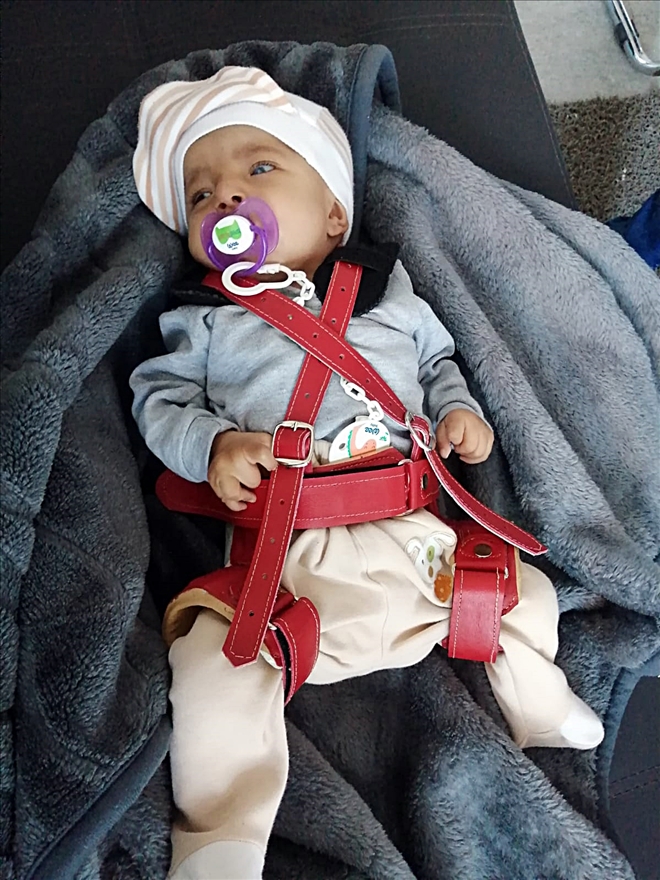 SURİYELİ BEBEĞİN TEDAVİSİNİ ÜSTLENDİLER