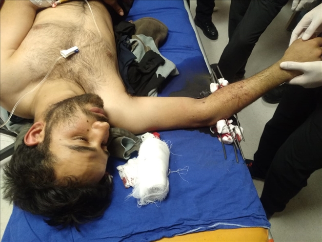 KOLUNA ÇELİK TEL SAPLANDI