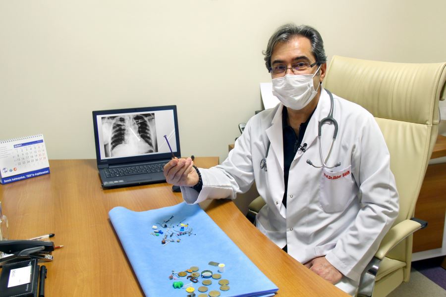 YANLIŞLIKLA YUTULAN CİSİMLER KOLEKSİYON OLDU