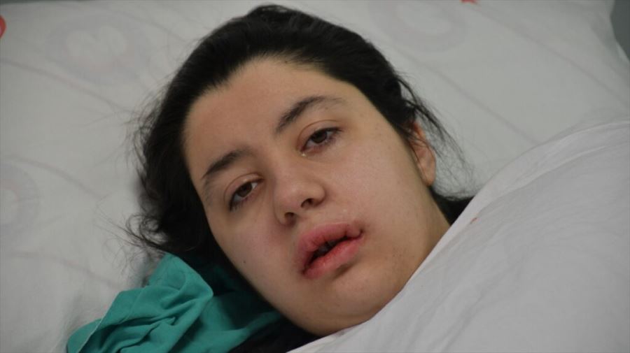 İLK KEZ YAPILAN AMELİYATLA SAĞLIĞINA KAVUŞTU