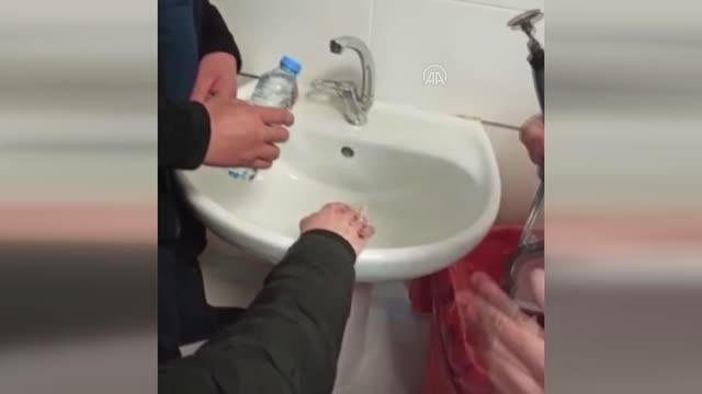 SIKIŞAN YÜZÜĞÜ İTFAİYE ÇIKARDI