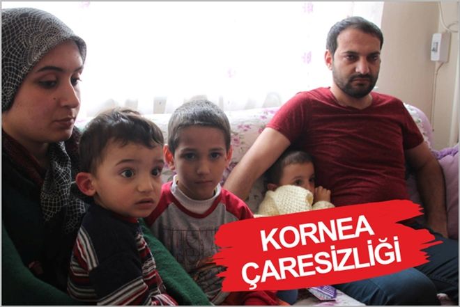 KORNEA ÇARESİZLİĞİ