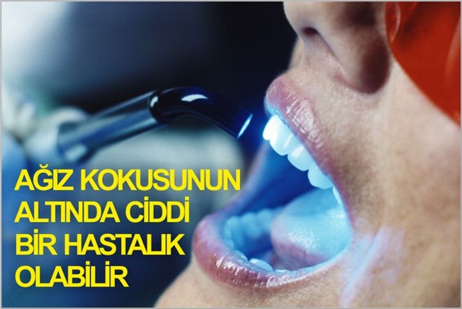 AĞIZ KOKUSUNUN ALTINDA  CİDDİ BİR HASTALIK OLABİLİR