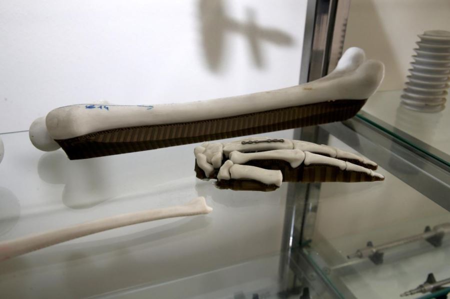 ESTAŞ medikal implant ihracatına başladı