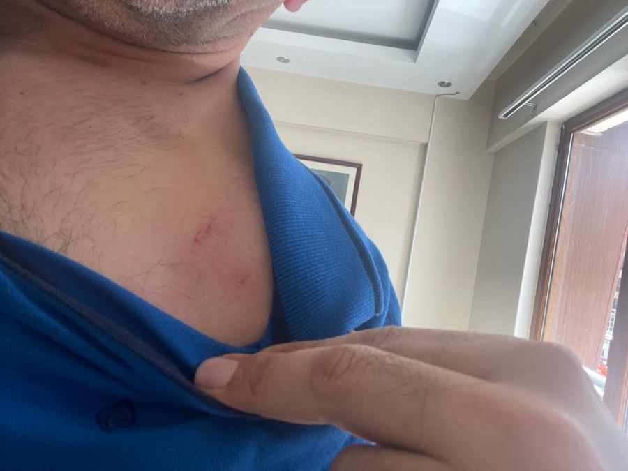 Tırnakçılarınıza sahip çıkın