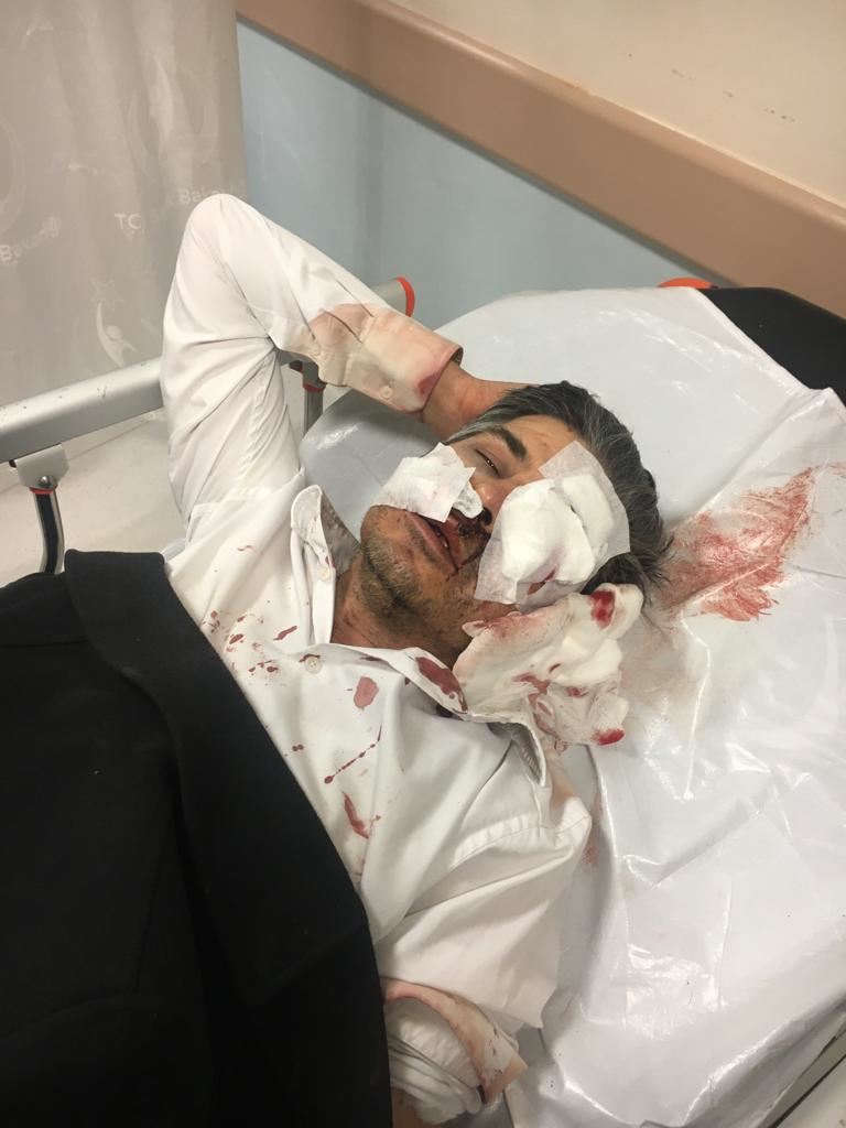 YILDIZ’A ÇİRKİN SALDIRI