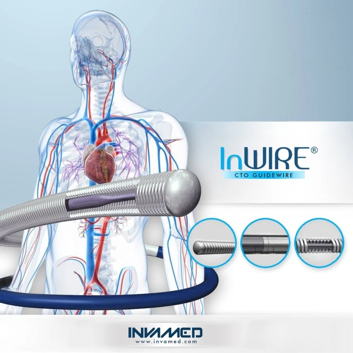 Tam Tıkalı Kalp Damarlarına Ameliyatsız Çözüm