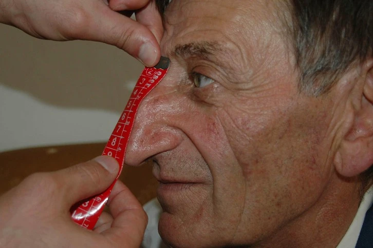 En Uzun Burunlu Adam Hayatını Kaybetti