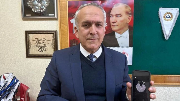 Tümörü Tespit Eden Yapay Zeka