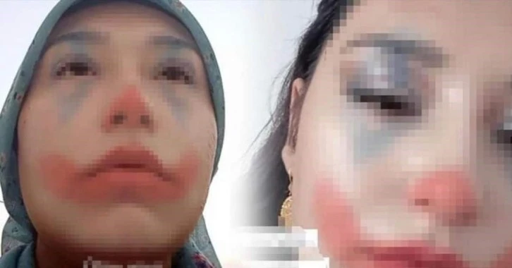 Küçük Yaşta Zorla Evlendirilen Kız Çocuğu Devlet Korumasına Alındı