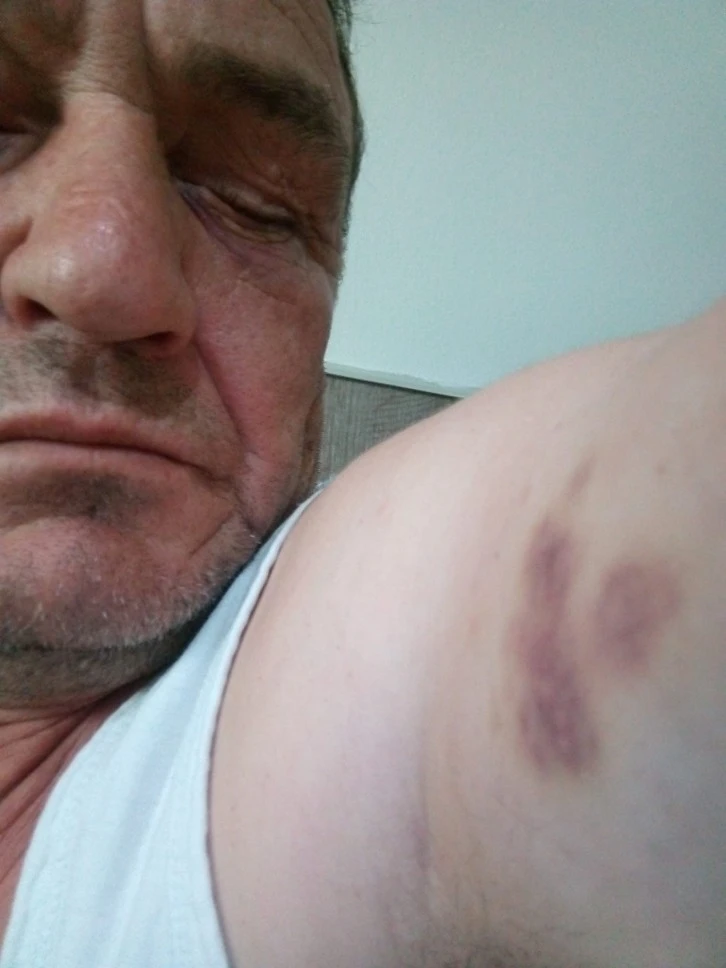 Otopark Sorunu Komşuları Birbirlerine Düşürdü