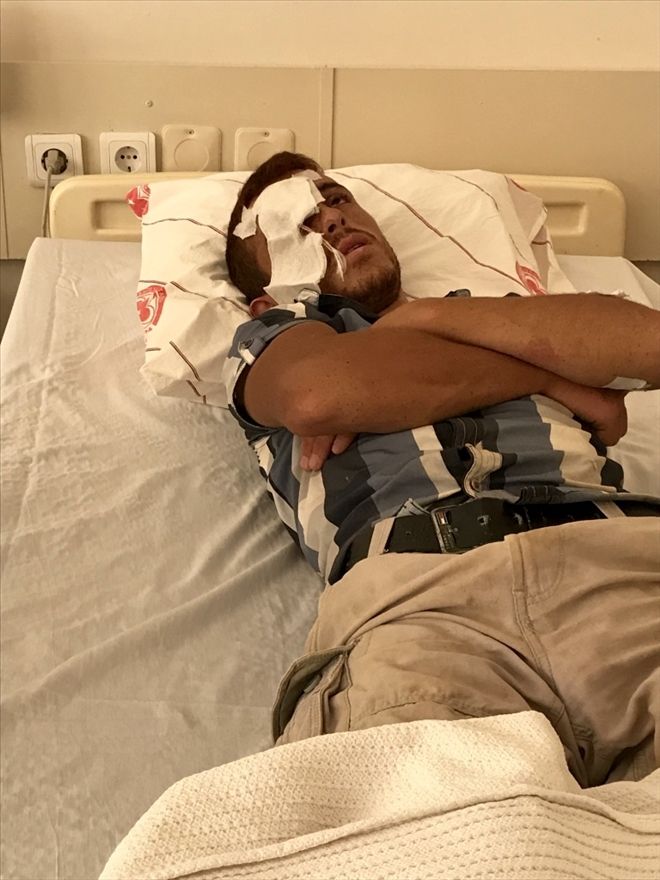 DUVAR ÖRERKEN GÖZÜNE 10 CM´lik  ÇİVİ SAPLANDI