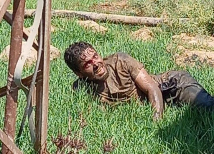 Kuduz Hastası Öldü