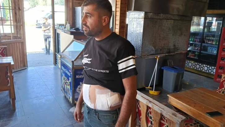 Kadınlara Laf Atanlara Tepki Gösterdi Karnından Bıçaklandı