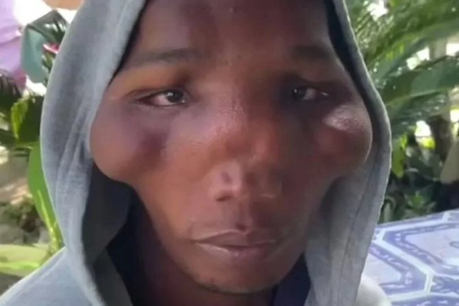 Bu Aileyi Gören Uzaylı Sanıyor! 