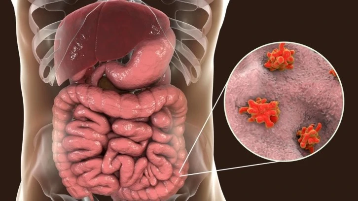 Dizanteri Hastalığına Dikkat!