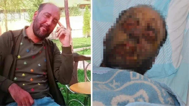 Yağmur Ormanlarında Görülen Hastalık Bu İlimizde 