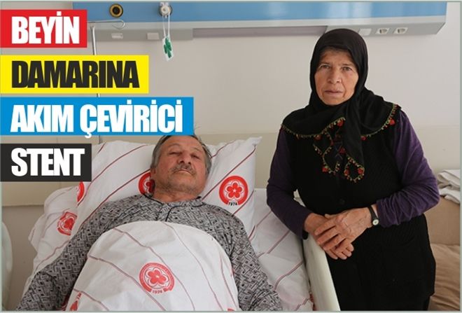 BEYİN DAMARINA AKIM ÇEVİRİCİ STENT
