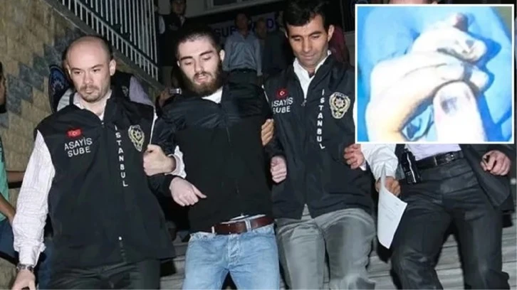  İşte Cem Garipoğlu'nun Parmaklarındaki Morarmaların Nedeni