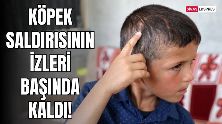 Köpek Saldırısının İzleri Başında Kaldı!