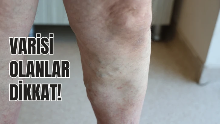 Varisi Olanlar Dikkat!