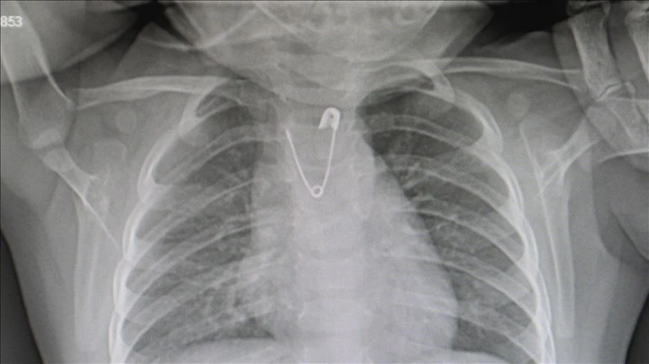 Bebeklere nazar boncuğu, kolye takılmamalı" uyarısı