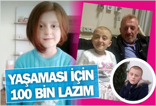 YAŞAMASI İÇİN 100 BİN LAZIM