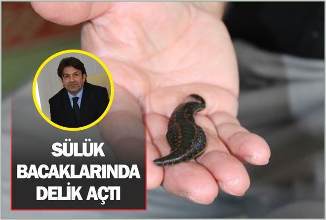 SÜLÜK BACAKLARINDA  DELİK AÇTI
