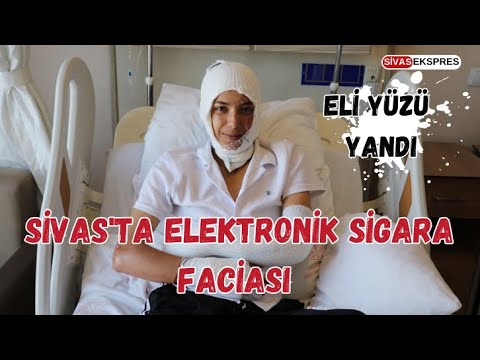 Sivas'ta Elektronik Sigara Faciası, Eli Yüzü Yandı