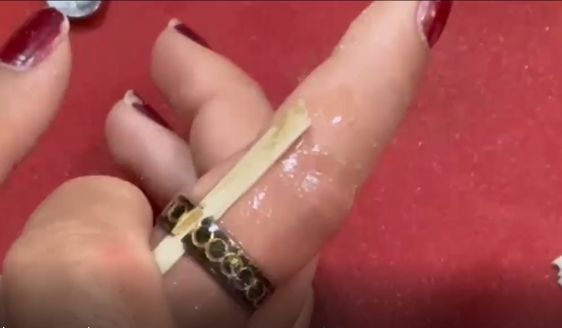 Sivas'ta Yüzük Alarmı! Keserek Çıkardılar