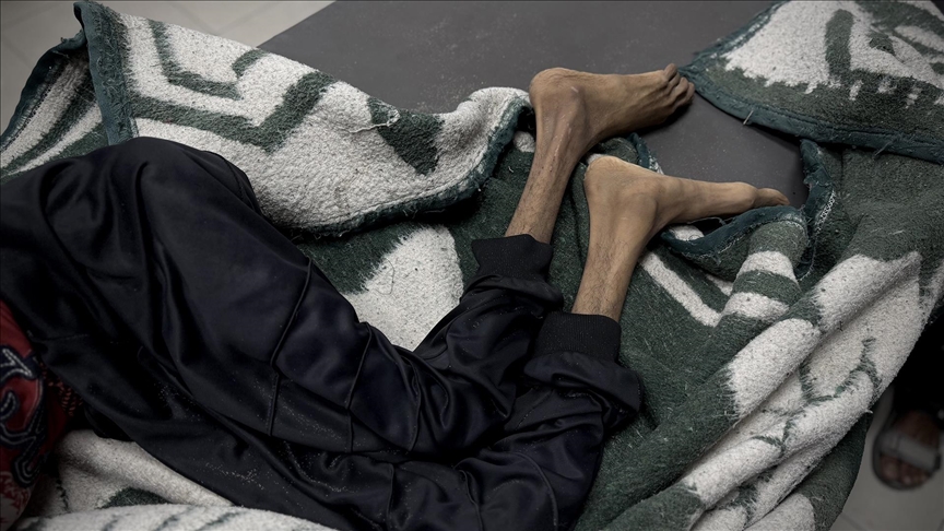 4'ü çocuk 15 Filistinli daha açlıktan hayatını kaybetti