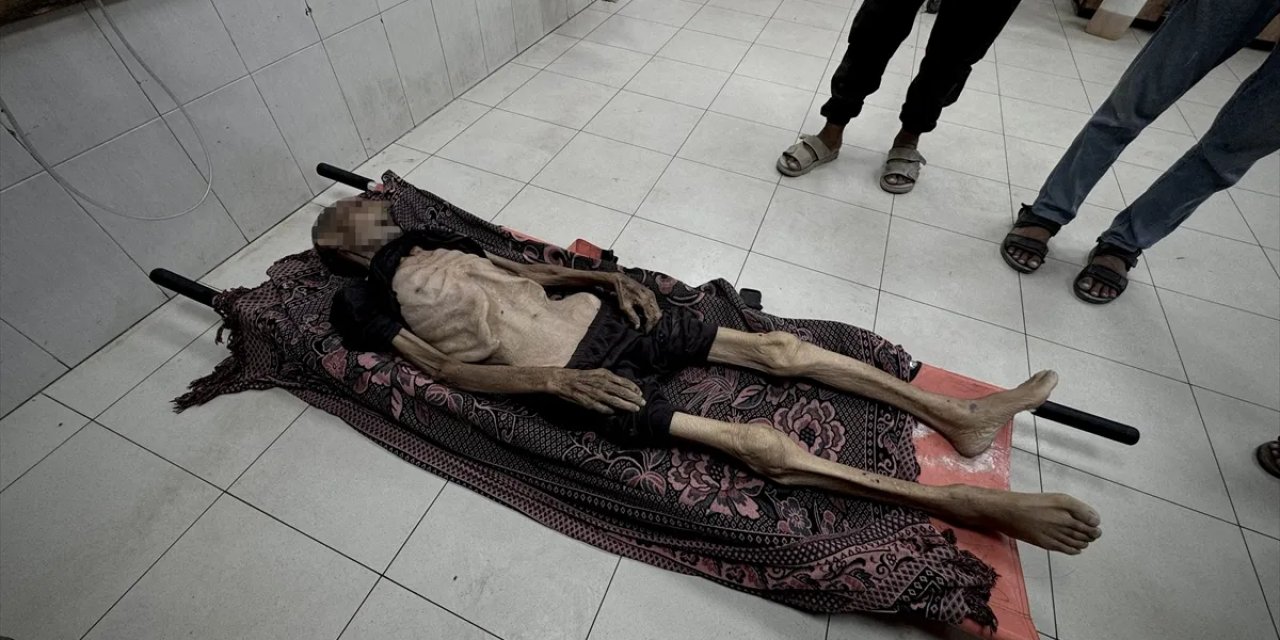 Açlık can almaya devam ediyor