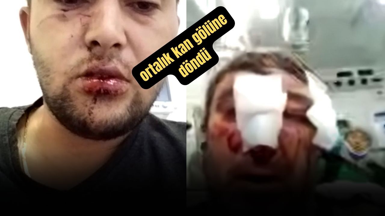 Sivas'ta Komşular Arasında Levyeli Kavga: 1'i Kadın 5 Yaralı