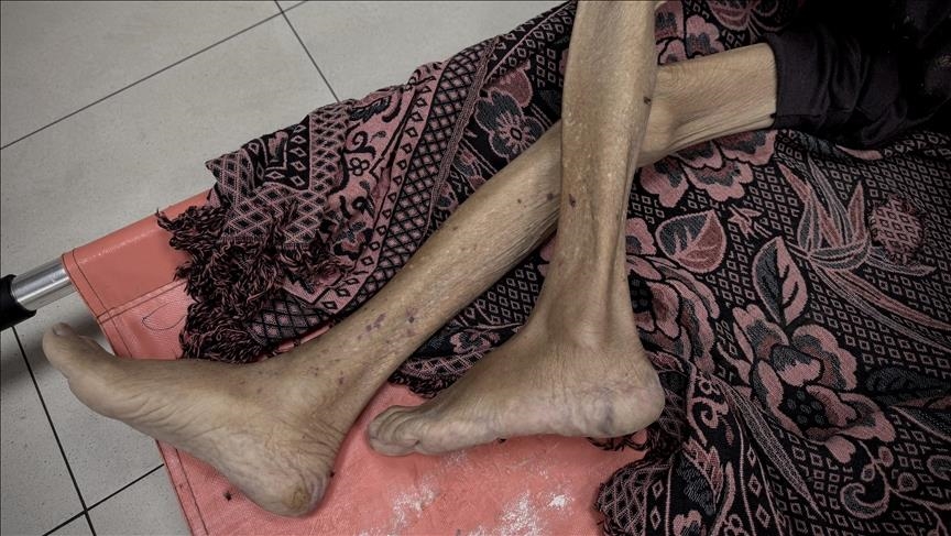 Açlıktan 3'ü çocuk 10 kişi öldü