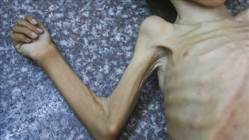 Gazze'de son 24 saatte 7 kişi daha açlıktan hayatını kaybetti