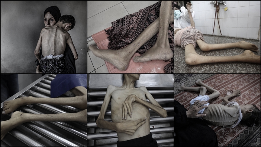 Gazze'de Açlık Ölümleri Artıyor