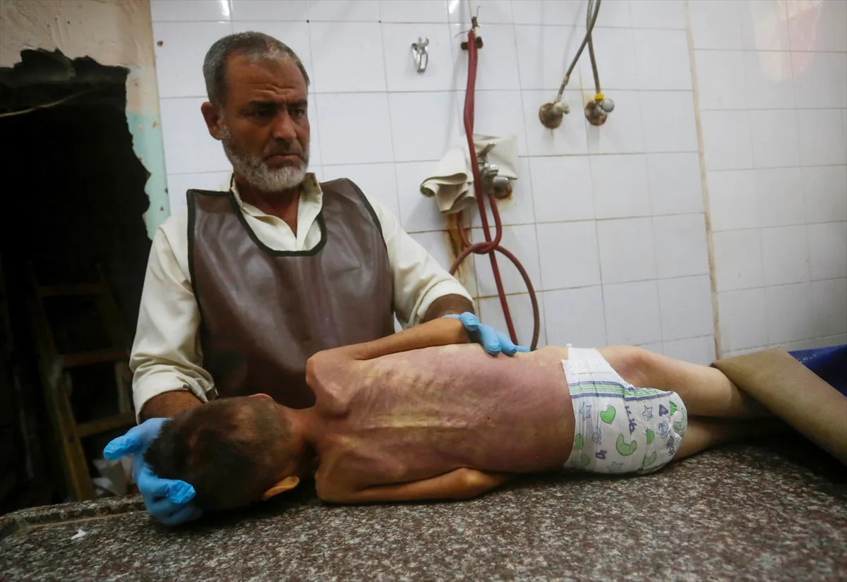 8 yaşındaki Muhammed açlıktan hayatını kaybetti