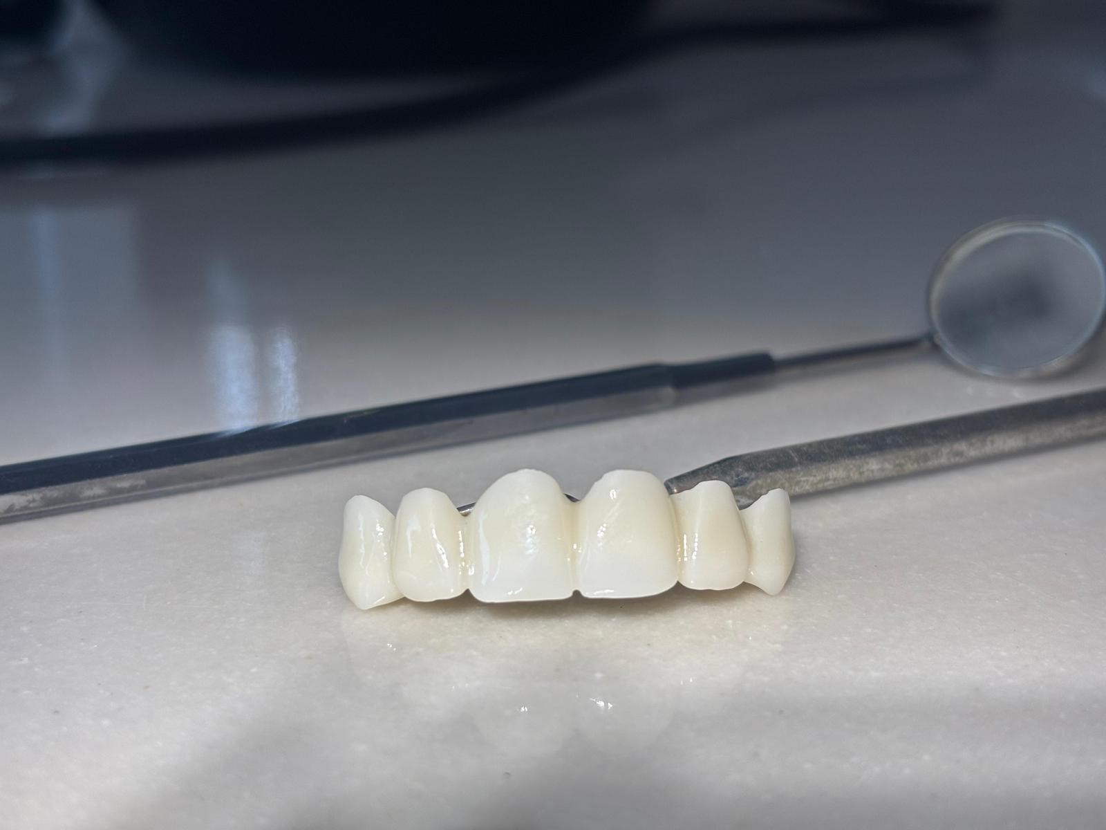 Sivas Ağız ve Diş Hastanesi, Dijital Zirkonyum Laboratuvarı ile Türkiye’de Öncü