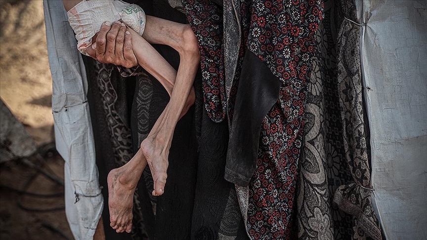 Gazze'de 453 kişi açlıktan hayatını kaybetti