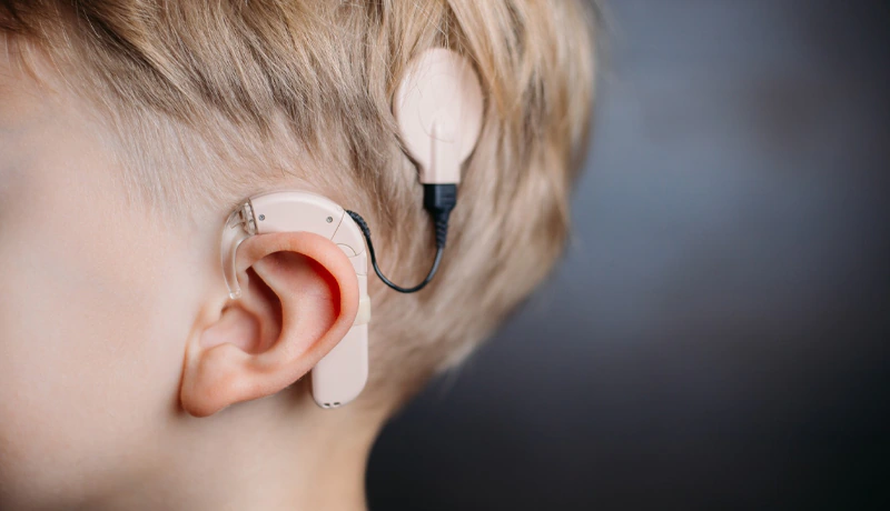 Sivas Belediyesi’nden İşitme Kaybı Olan Çocuklara Umut