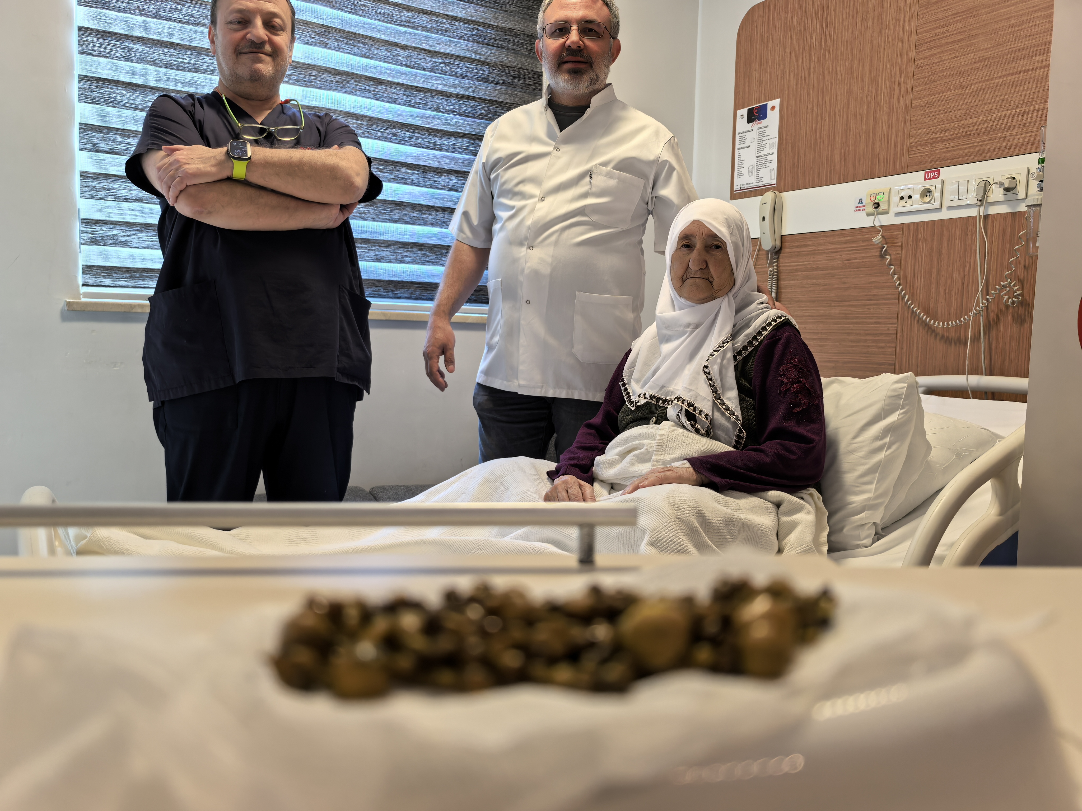 77 yaşındaki kadının safra kesesinden 213 tane taş çıkarıldı