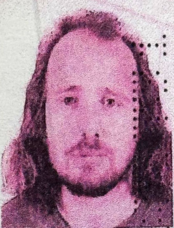 Türkiye'ye saç ekimi  için gelen İngiliz hayatını kaybetti