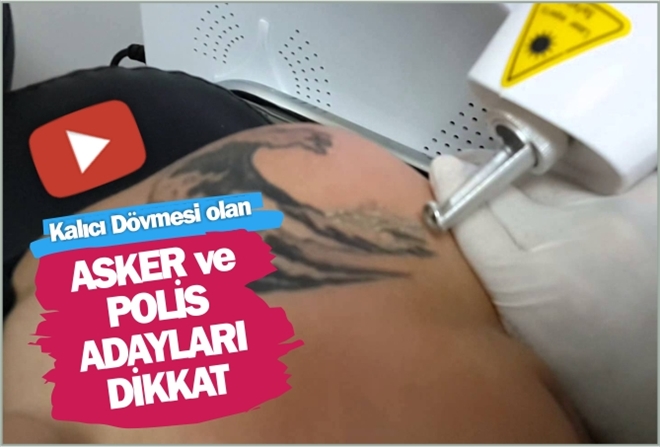 Kalıcı Dövmesi olan  ASKER ve POLİS ADAYLARI DİKKAT