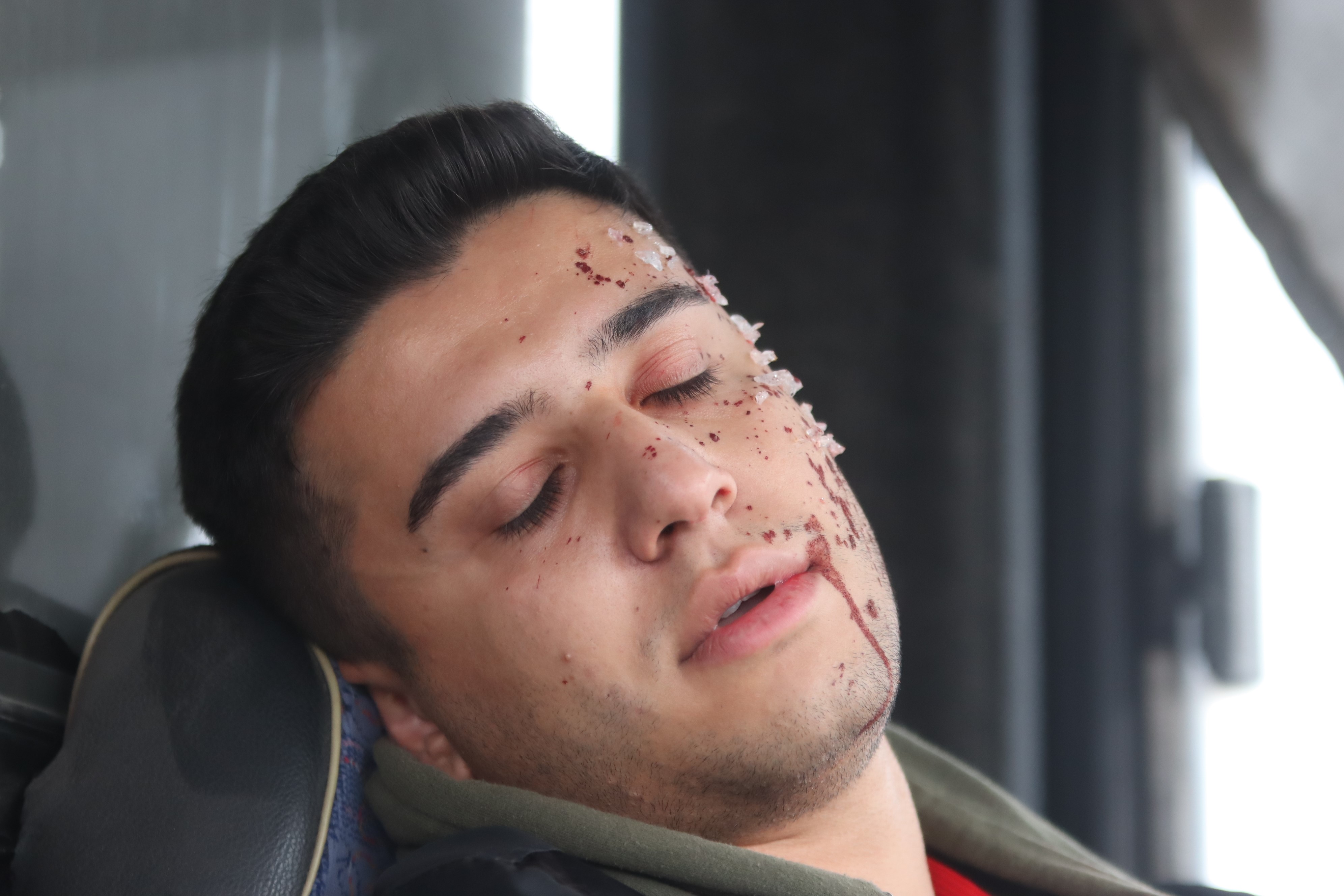 Sivas'tan Ekip Otobüs Kazasında