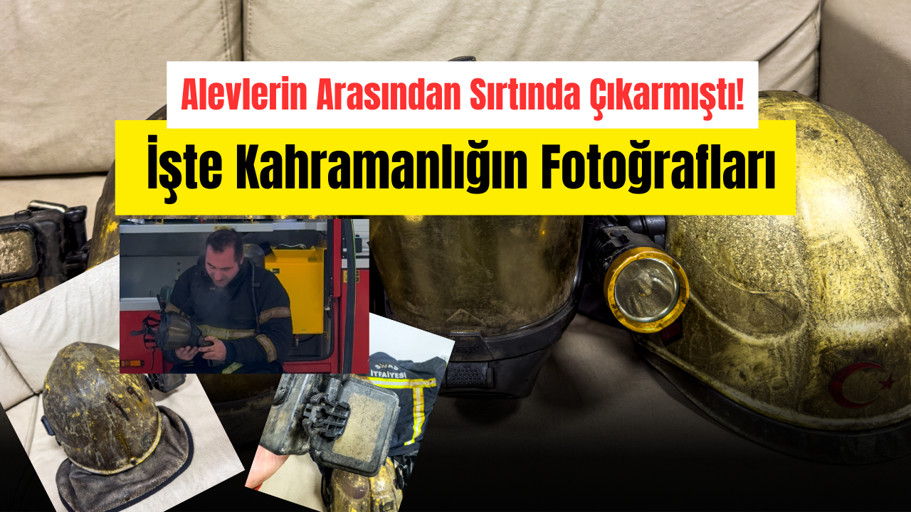 Alevlerin Arasından Sırtında Çıkarmıştı! İşte Kahramanlığın Fotoğrafları